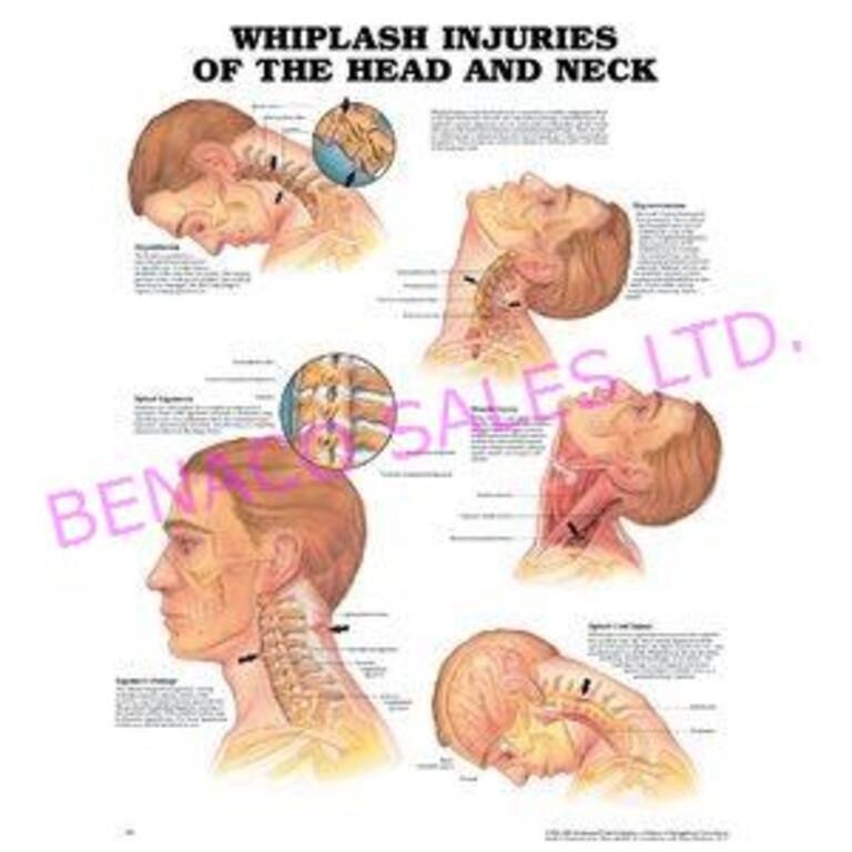 LOT, 12 ASST ANATOMY CHARTS