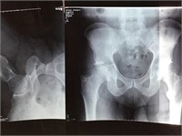 Medical X-Rays & MRI Films