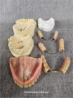 Vintage Dentures, Bridges, Dental Molds, Etc