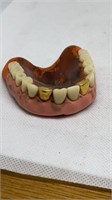 False chompers with 2 gold ones!