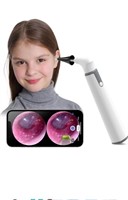 (New) Wireless Otoscope Ear Camera with Dual