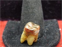 Dental gold tooth.
