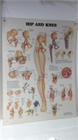1999 Anatomical Chart "Hip & Knee"  U15D