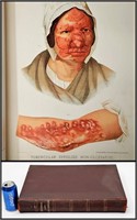 Antique 1889 Venereal & Skin Diseases Book w Plate