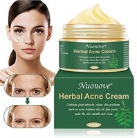 "SEALED" Acne treatment cream, acne scar cream, fa