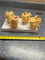 4 stage Lumbar Vertebrae Spinal Model