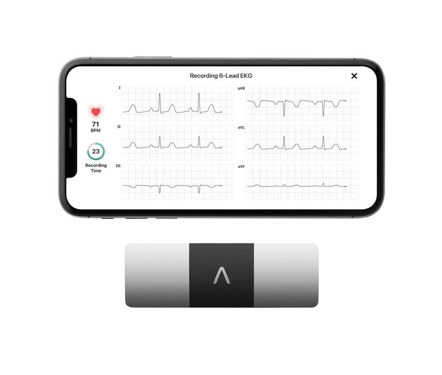 KardiaMobile Six-Lead Personal EKG Monitor -