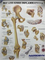 VINTAGE HIP AND KNEE INFLAMMATIONS POSTER