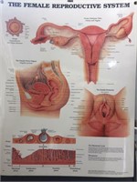 20" x 26" Female Reproductive System Illustration
