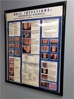 Nail Infection Poster