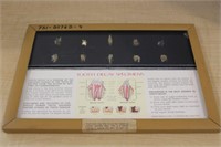 FRAMED TOOTH DECAY SPECIMENS
