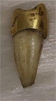 (ST) Gold capped tooth