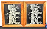 2 Framed Spine Anatomy Prints w Disc & Nerve Text