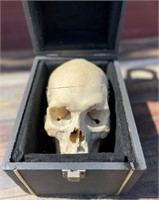 Human skull medical specimen
