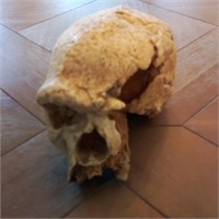 Somso Homo Sapiens Steinheimensis Model Skull