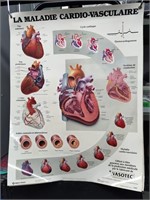 Tableau des maladies cardiovasculaires : Laminé