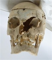 Dis-articulated Human Skull