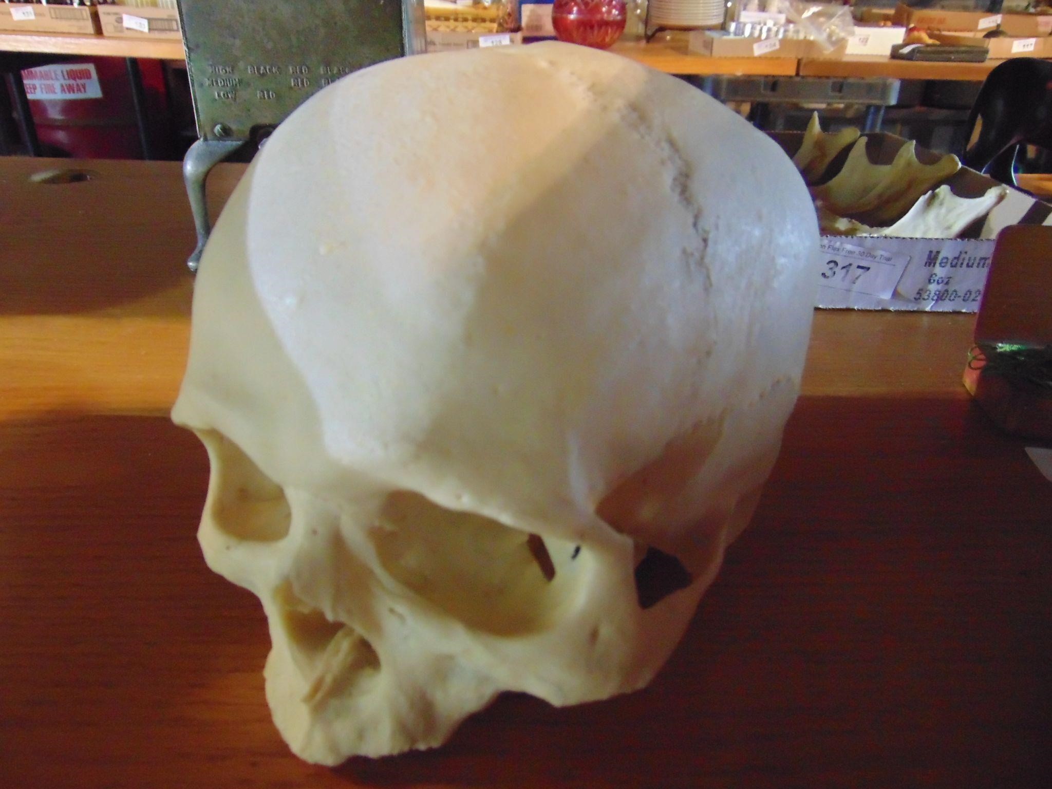 Another Old Childs Skull, missing lower jaw