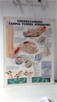 1995 Anatomical Chart : Carpal Tunnel U15 D