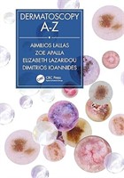 Dermatoscopy A-Z 1st Edition