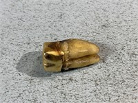 Gold capped tooth
