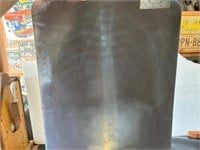 Vintage X-rays. Skeleton.